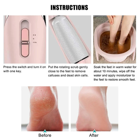 Electric Foot Pedicure