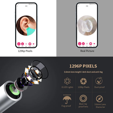 Ear Cleaner